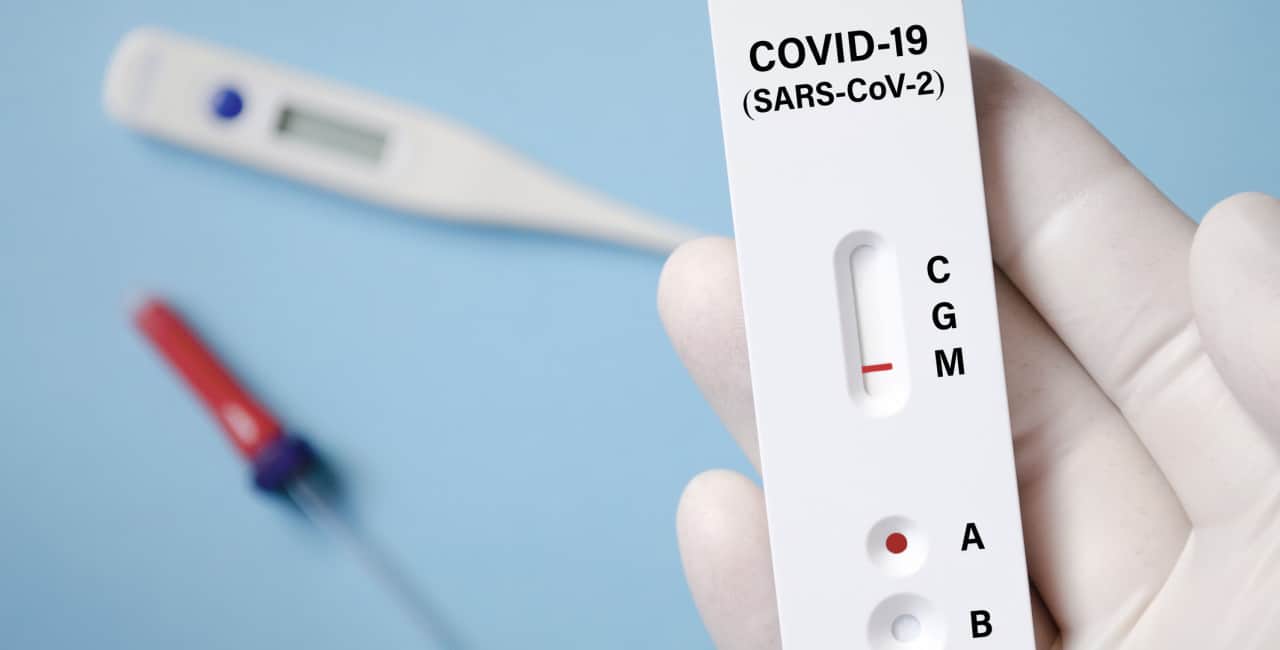 COVID Antigen Test